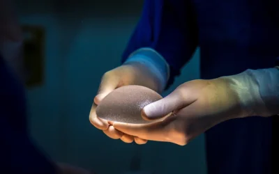 How to Choose Implant Size for the California Lifestyle