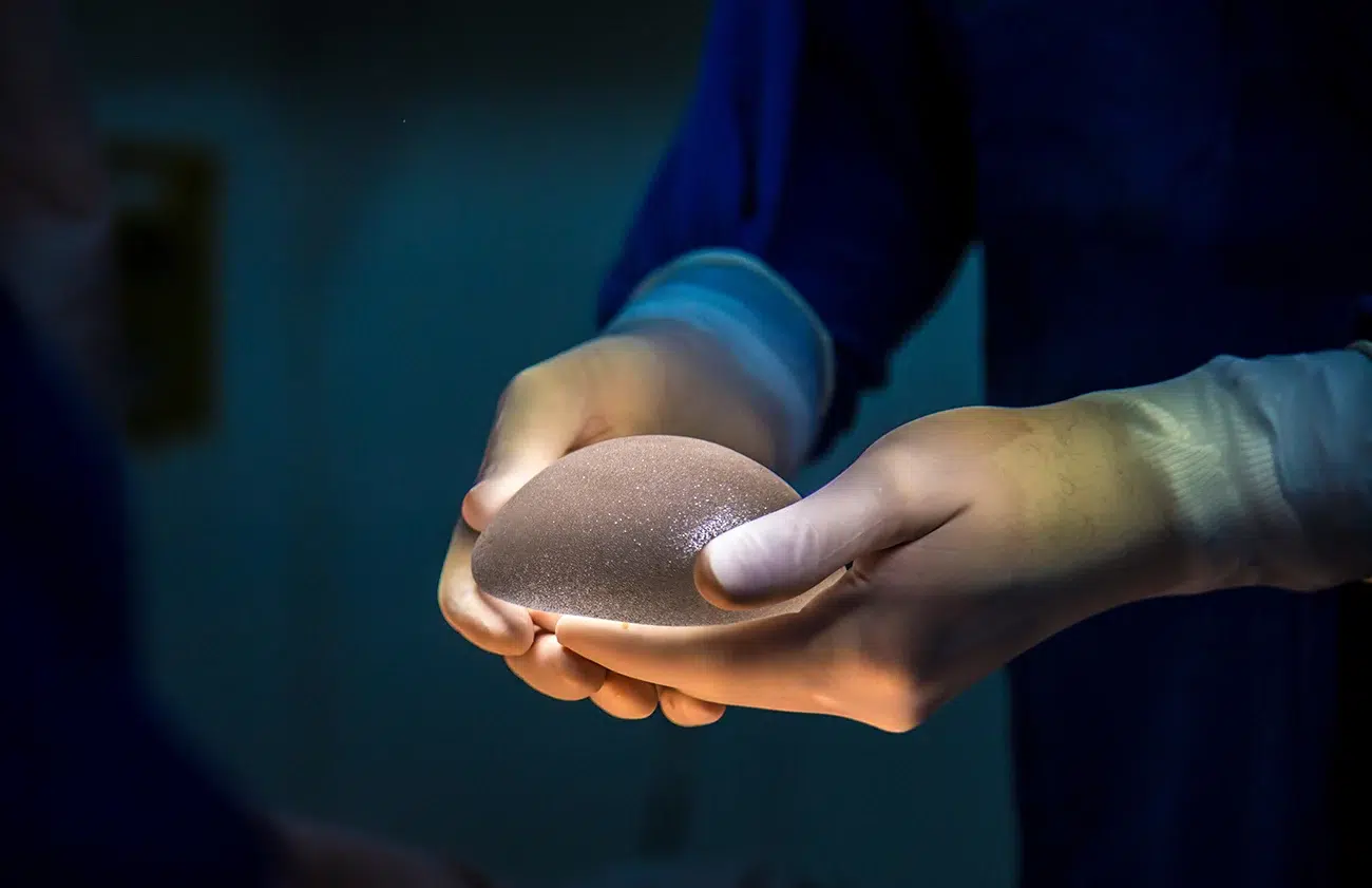 young woman plastic surgery institute of california young woman plastic surgery institute of california